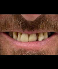 Before - GM Dental & Implant Centre