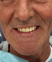 After - GM Dental & Implant Centre