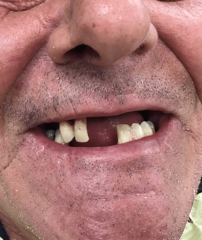 Before - GM Dental & Implant Centre