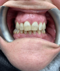 Before - GM Dental & Implant Centre