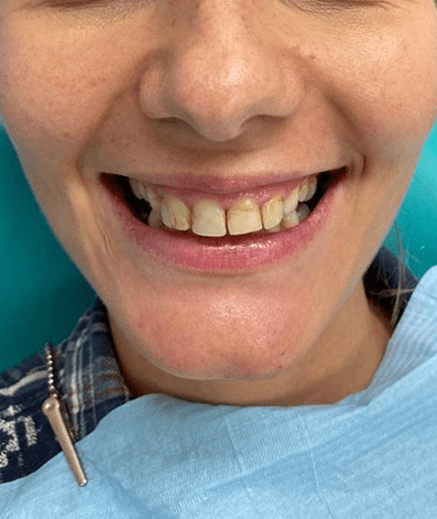 Before - GM Dental & Implant Centre