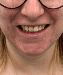 Before - GM Dental & Implant Centre