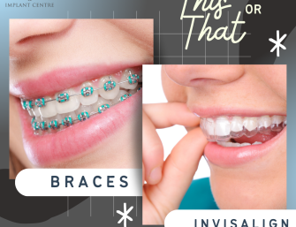 Metal braces, lingual braces, Invisalign, teeth straightening