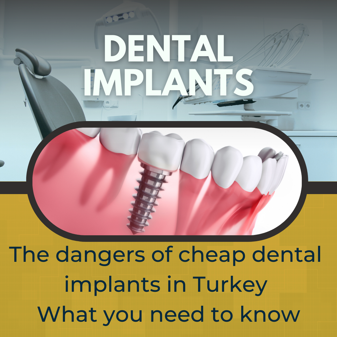 The Dangers Of Cheap Dental Implants In Turkey What You Need To Know