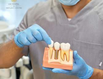 cost of dental implants in uk, Affordable dental implants.