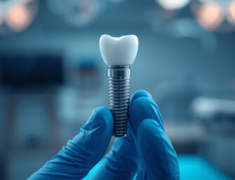 dental implants