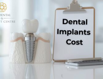 dental implants cost uk