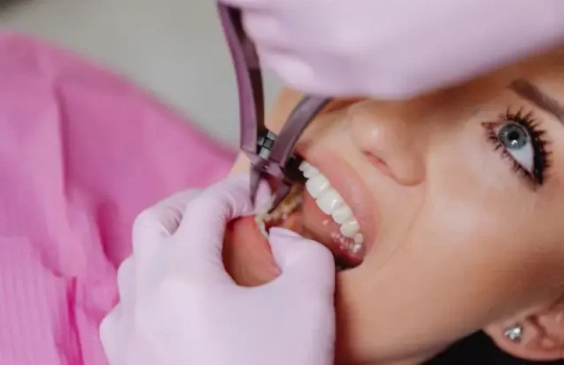 All on 4 Dental Implants In Barnet