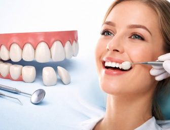 Cost Of Dental Veeners In North London