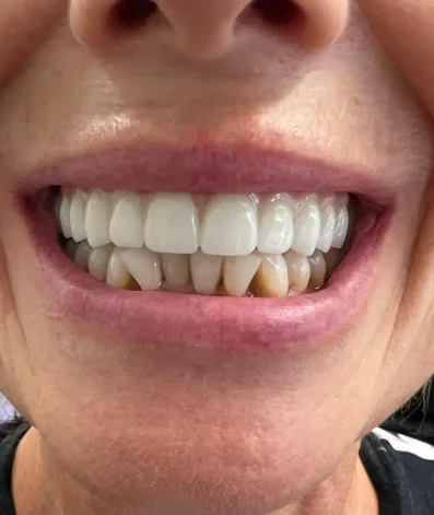 Case 14 After