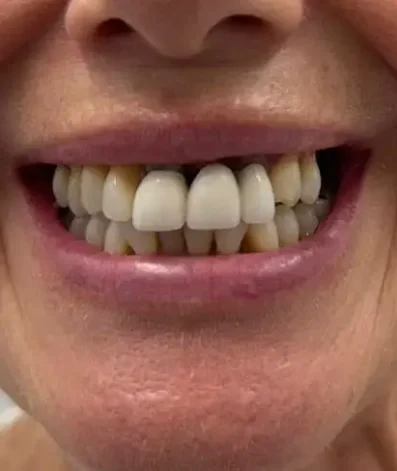 Case 14 Before