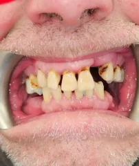 Case 13 Before
