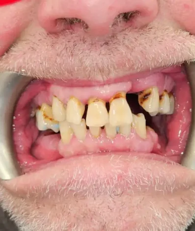 Case 13 Before