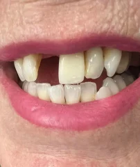 Case 11 Before
