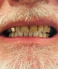 Case 18 Before