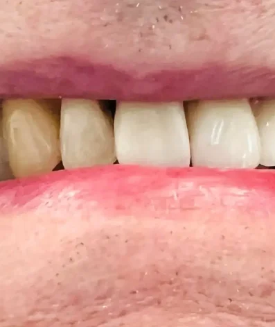 Case 19 After