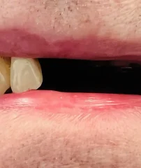Case 19 Before