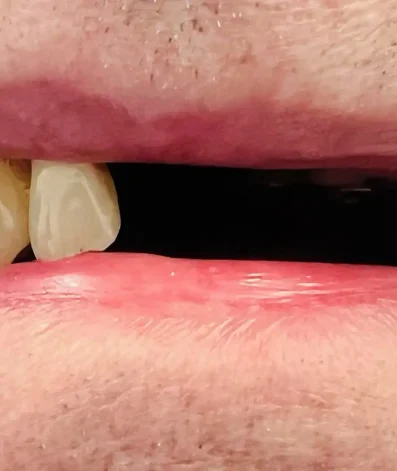 Case 19 Before