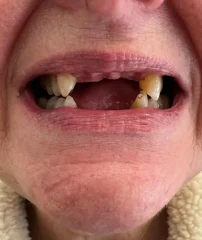 Case 20 Before