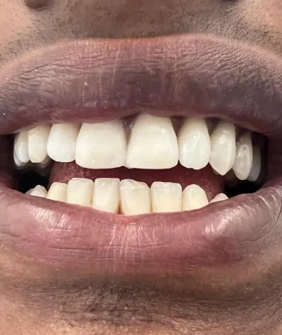 Case 23 After