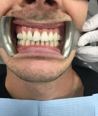 Case 25