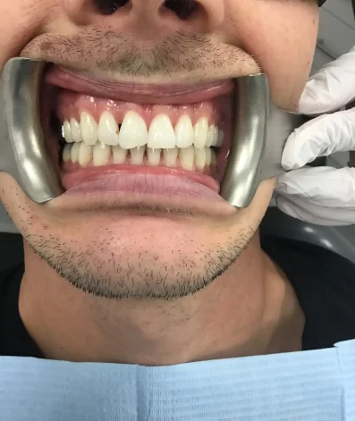 Case 25