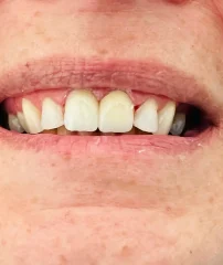 Case 27 After