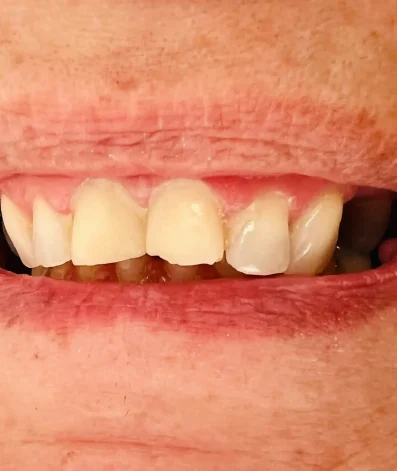 Case 27 Before