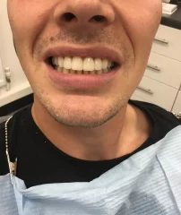 Case 25 After