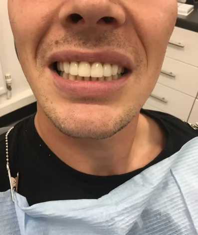 Case 25 After